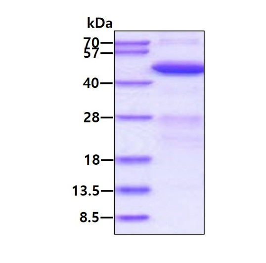 SDS-PAGE gel of recombinant human ADRM1 protein under reducing conditions Coomassie blue stain
