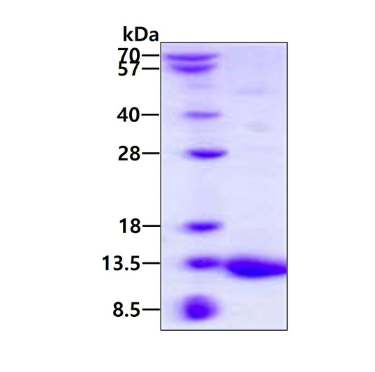 SDS-PAGE gel of recombinant mouse S100A5 protein 3µg under reducing conditions Coomassie blue stain