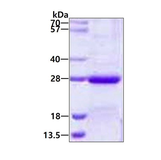 SDS-PAGE of recombinant human NKIRAS2 protein under reducing conditions stained with Coomassie blue