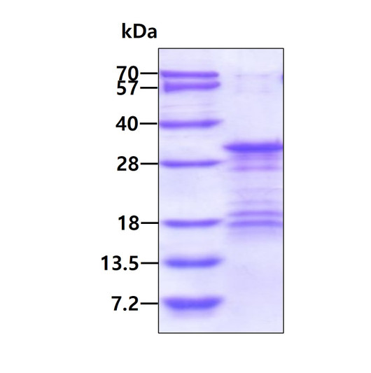 SDS-PAGE gel of recombinant human VTI1B protein 3ug under reducing conditions with Coomassie blue stain