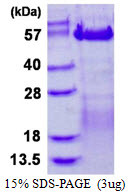 SDS-PAGE gel of recombinant human VRK3 protein under reducing conditions Coomassie blue stain
