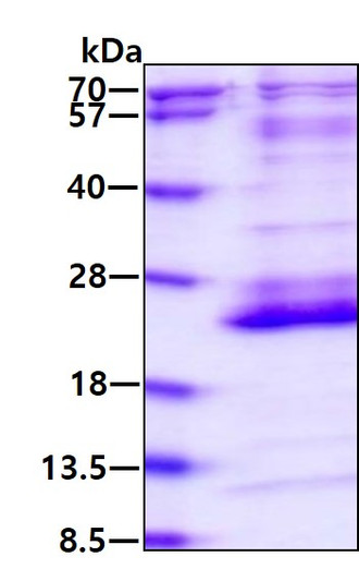 SDS-PAGE of recombinant human RhoG protein under reducing conditions stained with Coomassie blue