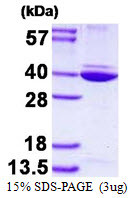 SDS-PAGE gel of recombinant human ANXA8L1 protein STJP017708 3μg reducing conditions