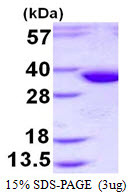 SDS-PAGE gel of recombinant human Epimorphin Syntaxin 2 protein 3µg Coomassie blue stain