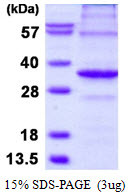SDS-PAGE gel of recombinant human APIP protein under reducing conditions stained with Coomassie blue