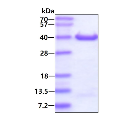 SDS-PAGE gel showing recombinant human DIMT1 protein 3µg under reducing conditions with Coomassie blue stain