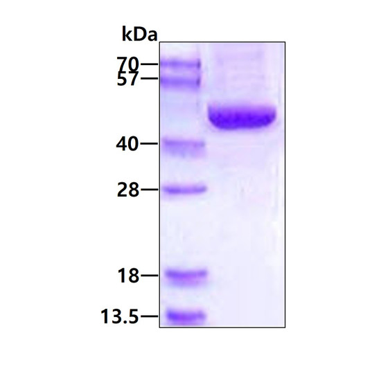 SDS-PAGE gel of recombinant human ACADSB protein under reducing conditions