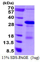 SDS-PAGE of recombinant human DBNDD1 protein under reducing conditions