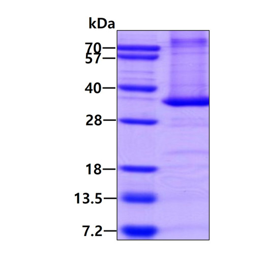 SDS-PAGE of recombinant mouse PD-L1 B7-H1 protein under reducing conditions
