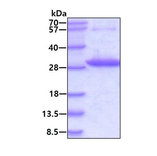 Recombinant human CMBL protein SDS-PAGE gel under reducing conditions stained with Coomassie blue