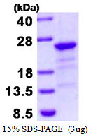 SDS-PAGE of recombinant human HBXIP LAMTOR5 protein under reducing conditions