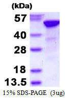 SDS-PAGE gel of recombinant human RBBP4 protein under reducing conditions