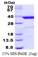 SDS-PAGE gel of recombinant human Syntaxin 4 protein stained with Coomassie blue