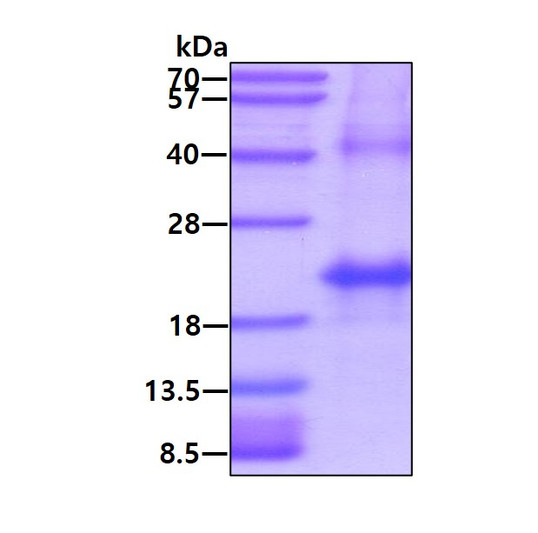 SDS-PAGE of recombinant human hemoglobin subunit alpha protein under reducing conditions