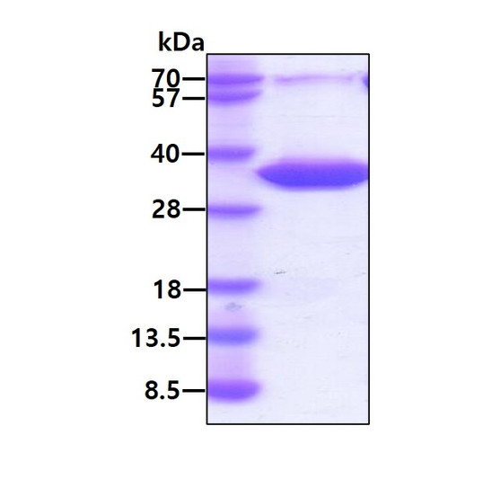 SDS-PAGE gel of recombinant human Coagulation Factor III Tissue Factor protein under reducing conditions