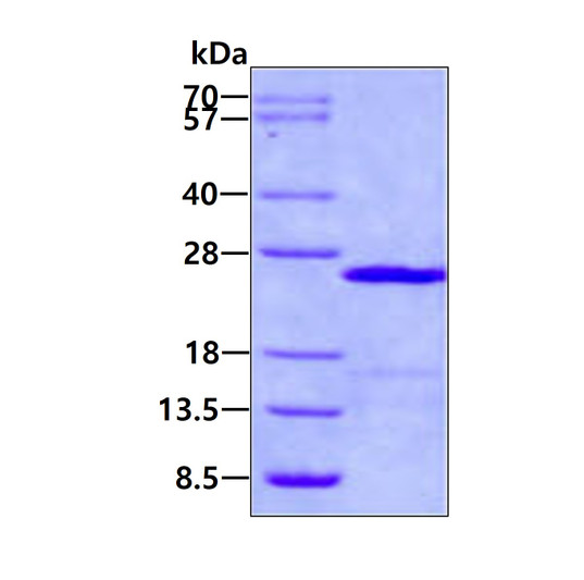 SDS-PAGE gel of recombinant human UbcH6 UBE2E1 protein under reducing conditions