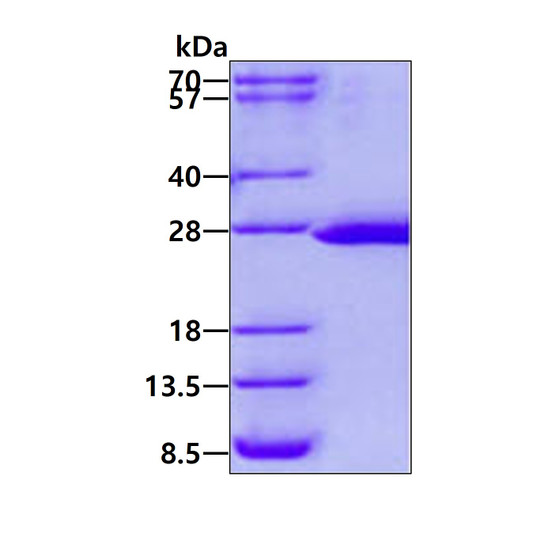 SDS-PAGE gel of recombinant human FTSJ2 protein under reducing conditions Coomassie blue stain