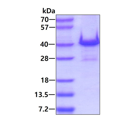 SDS-PAGE gel of recombinant human WBP2 protein 3µg under reducing conditions stained with Coomassie blue