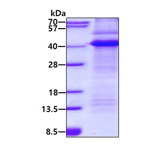 SDS-PAGE gel of recombinant human CD68 protein stained with Coomassie blue
