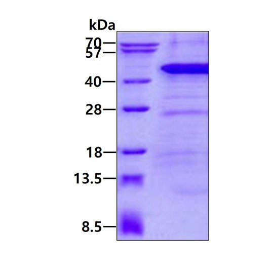 SDS-PAGE gel of recombinant human ANKRD1 protein 3µg under reducing conditions Coomassie blue stain