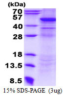 SDS-PAGE gel of recombinant human UQCRC2 protein under reducing conditions Coomassie blue stain