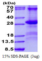 SDS-PAGE of recombinant human CD84 SLAMF5 protein under reducing conditions stained with Coomassie blue