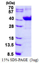 SDS-PAGE gel of recombinant human NDUFAF1 protein under reducing conditions with Coomassie blue stain