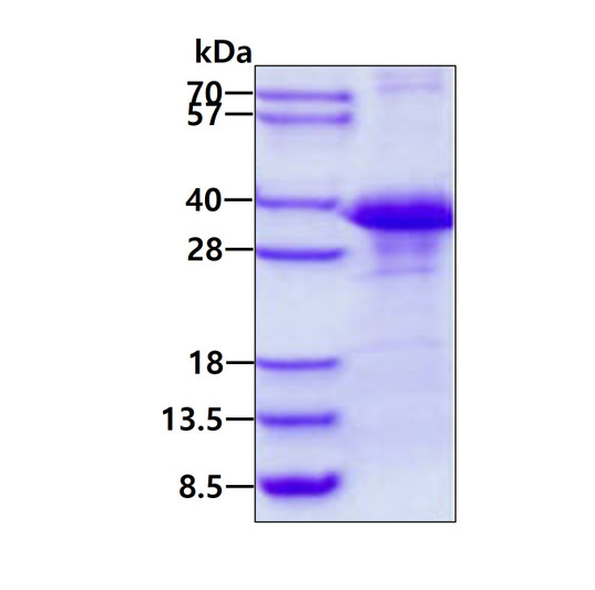SDS-PAGE gel of recombinant human CLNS1A protein stained with Coomassie blue