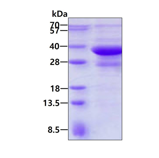 SDS-PAGE of recombinant human Endophilin B1 Bif-1 protein under reducing conditions