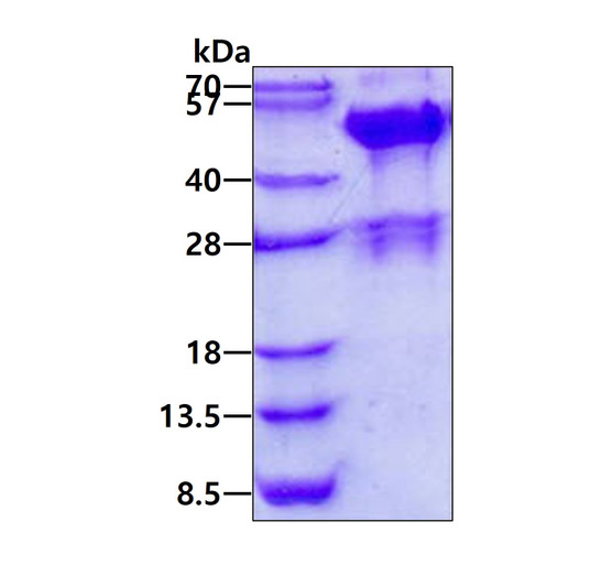 SDS-PAGE gel showing recombinant human Endophilin B2 SH3GLB2 protein under reducing conditions