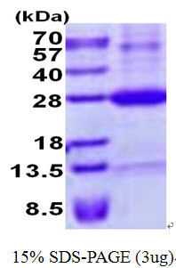 SDS-PAGE gel showing recombinant human ULBP-4 RAET1E protein under reducing conditions