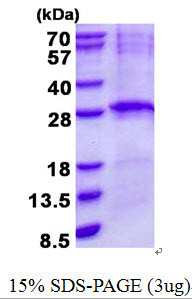 SDS-PAGE gel of recombinant human LIN-7B protein under reducing conditions stained with Coomassie blue