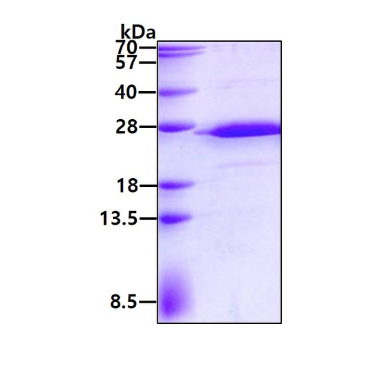 SDS-PAGE gel of recombinant human RPS5 protein 3µg under reducing conditions stained with Coomassie blue