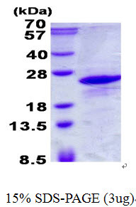 SDS-PAGE gel of recombinant human ICT1 protein under reducing conditions stained with Coomassie blue