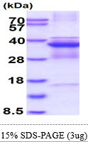 SDS-PAGE gel of recombinant human CDK5 protein 3µg under reducing conditions Coomassie blue stain