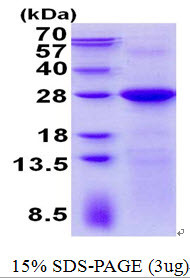 SDS-PAGE gel of recombinant human LIN-7C protein under reducing conditions