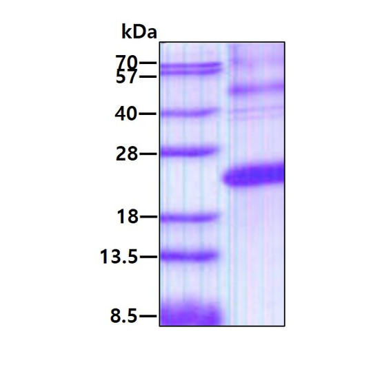 SDS-PAGE of recombinant human Endocan ESM1 protein under reducing conditions