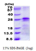 SDS-PAGE gel showing 3 μg recombinant human BTF3 protein under reducing conditions Coomassie blue stain