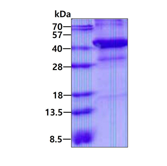 SDS-PAGE of recombinant human XRCC3 protein under reducing conditions Coomassie blue stain