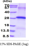 SDS-PAGE gel of recombinant human Complement Factor D protein under reducing conditions