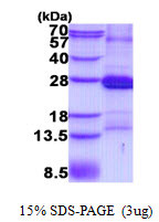 SDS-PAGE of recombinant human CD2 protein under reducing conditions with Coomassie blue stain