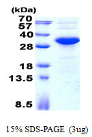 SDS-PAGE of recombinant human KCTD15 protein under reducing conditions with Coomassie blue stain