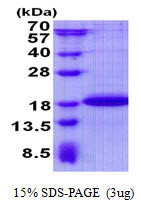 SDS-PAGE gel of recombinant human SDHAF2 protein under reducing conditions Coomassie blue stain
