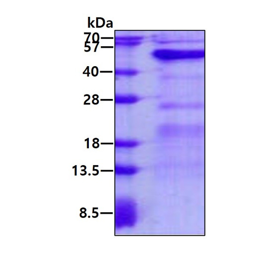 SDS-PAGE gel of recombinant human GALT protein 3µg under reducing conditions stained with Coomassie blue
