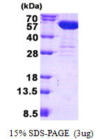 SDS-PAGE gel of recombinant human CNDP2 CPGL protein under reducing conditions Coomassie blue stain