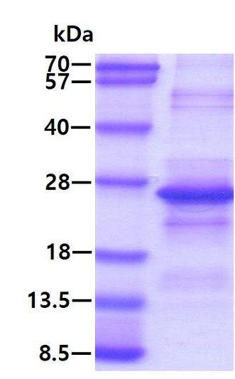 SDS-PAGE gel of recombinant human CD300C protein under reducing conditions stained with Coomassie blue