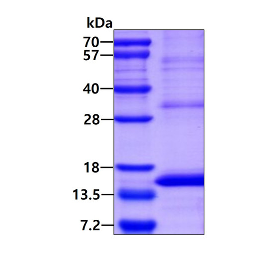 SDS-PAGE of recombinant human GP9 protein under reducing conditions stained with Coomassie blue