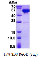 SDS-PAGE of recombinant human guanine deaminase GDA protein under reducing conditions