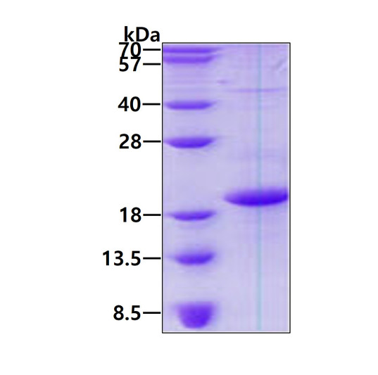 SDS-PAGE of recombinant human CD83 protein 3 µg under reducing conditions Coomassie blue stain