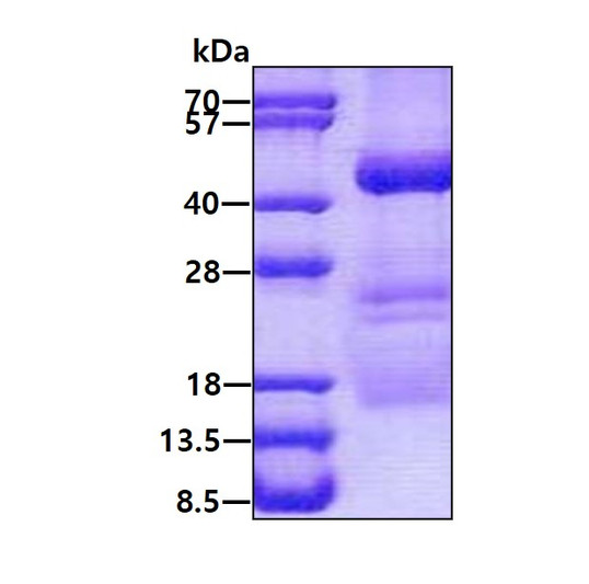 SDS-PAGE gel of recombinant human XPA protein STJP018039
